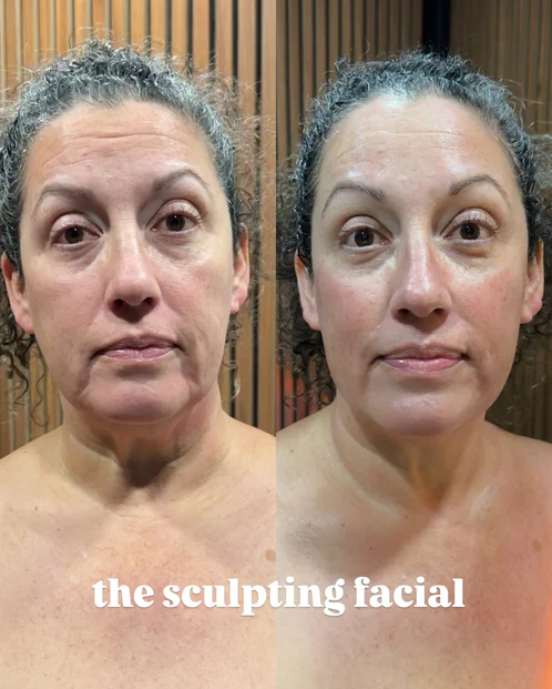 Before and after result 5